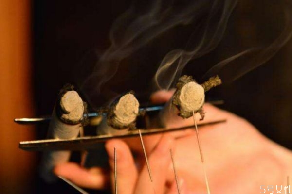 什么是三九灸 三九灸的好處與功效 什么是三九灸 三九灸的好處與功效