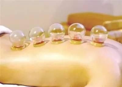 女人拔火罐的好處 冬天拔火罐減肥效果好嗎 女人拔火罐的好處 冬天拔火罐減肥效果好嗎