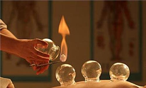 拔罐減肥需要每天拔嗎 拔罐減肥拔哪些部位 拔罐減肥需要每天拔嗎 拔罐減肥拔哪些部位