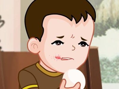 口角炎吃什么好 口角炎不適合吃什么食物 口角炎吃什么好 口角炎不適合吃什么食物