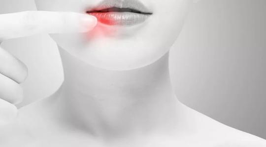 口角炎吃什么好 口角炎不適合吃什么食物 口角炎吃什么好 口角炎不適合吃什么食物