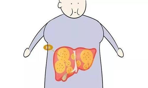 脂肪肝適合喝蜂蜜嗎 脂肪肝能吃雞蛋嗎 脂肪肝適合喝蜂蜜嗎 脂肪肝能吃雞蛋嗎