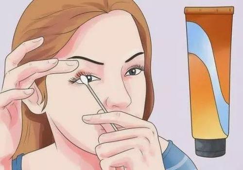 麥粒腫可以戴隱形眼鏡嗎 麥粒腫能傳染嗎 麥粒腫可以戴隱形眼鏡嗎 麥粒腫能傳染嗎