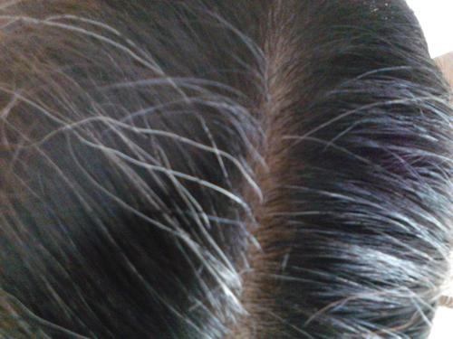 焦慮會長白頭發(fā)嗎 白頭發(fā)如何預防 焦慮會長白頭發(fā)嗎 白頭發(fā)如何預防