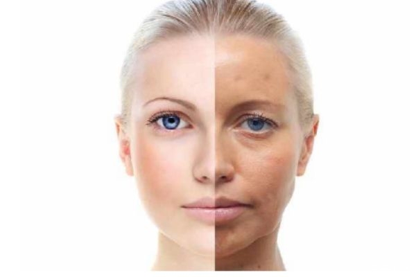 皮膚暗黃還愛長斑用什么護(hù)膚品好