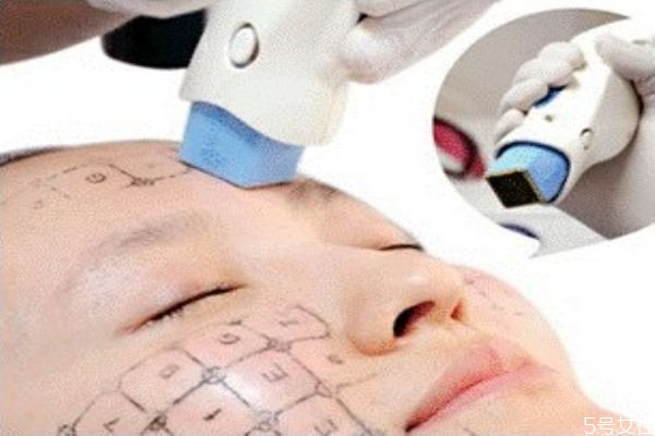 熱瑪吉多久做一次合適 熱瑪吉一次多少錢 熱瑪吉多久做一次合適 熱瑪吉一次多少錢