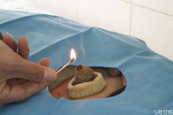 艾灸肚臍眼的功效 艾灸肚臍眼的時間 艾灸肚臍眼的功效 艾灸肚臍眼的時間