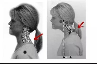 富貴包是骨頭還是肉呢 長(zhǎng)富貴包日常要注意什么 富貴包是骨頭還是肉呢 長(zhǎng)富貴包日常要注意什么