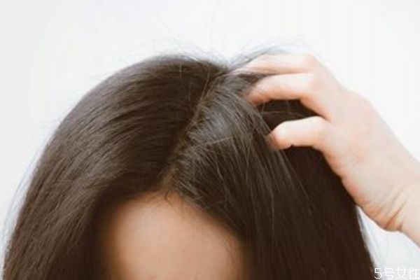 使用蓬蓬粉有什么害處 蓬蓬粉會(huì)導(dǎo)致掉頭發(fā)嗎 使用蓬蓬粉有什么害處 蓬蓬粉會(huì)導(dǎo)致掉頭發(fā)嗎