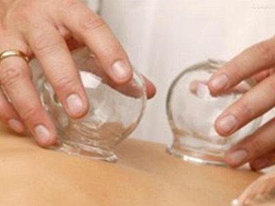 腹部拔罐減肥拔哪里 拔罐減肥包含哪些方法 腹部拔罐減肥拔哪里 拔罐減肥包含哪些方法