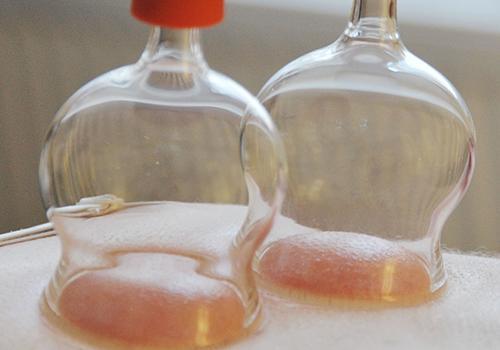 腹部拔罐會(huì)影響月經(jīng)嗎 腹部拔罐減肥的時(shí)間多久較好 腹部拔罐會(huì)影響月經(jīng)嗎 腹部拔罐減肥的時(shí)間多久較好