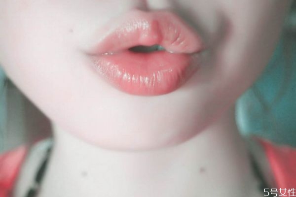 嘴唇顏色太暗是怎么回事 嘴唇顏色暗怎么調(diào)理 嘴唇顏色太暗是怎么回事 嘴唇顏色暗怎么調(diào)理
