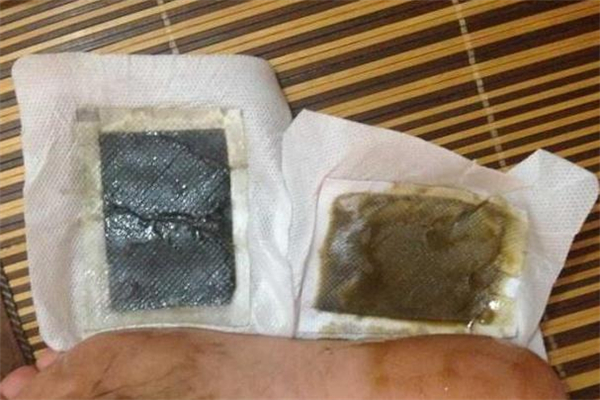 老北京足貼能減肥嗎 老北京足貼能貼肚臍嗎 老北京足貼能減肥嗎 老北京足貼能貼肚臍嗎