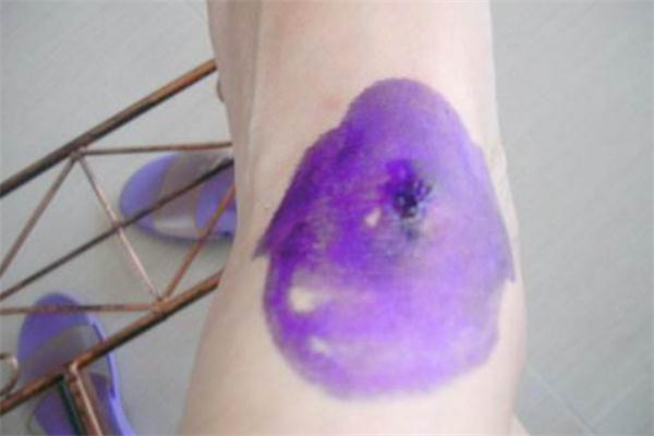 紫藥水可以直接涂到傷口嗎 紫藥水怎么用 紫藥水可以直接涂到傷口嗎 紫藥水怎么用