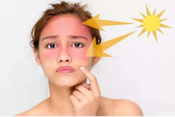 皮膚曬傷蛻皮怎么辦 皮膚曬傷蛻皮怎么修復(fù) 皮膚曬傷蛻皮怎么辦 皮膚曬傷蛻皮怎么修復(fù)