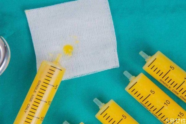 小腿吸脂會反彈嗎 小腿吸脂能反彈嗎 小腿吸脂會反彈嗎 小腿吸脂能反彈嗎