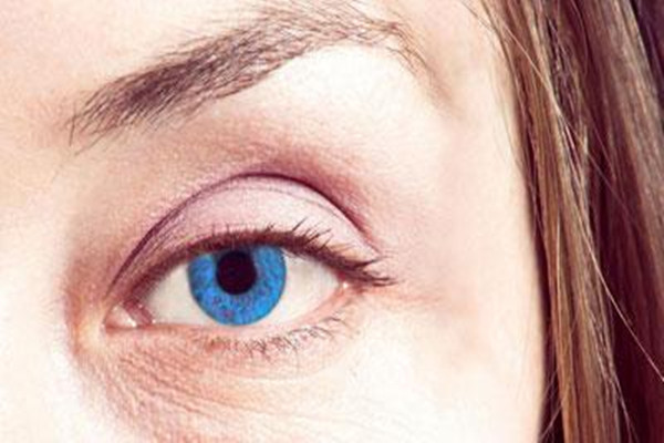 下眼紋怎么消除 下眼紋消除的方法 下眼紋怎么消除 下眼紋消除的方法