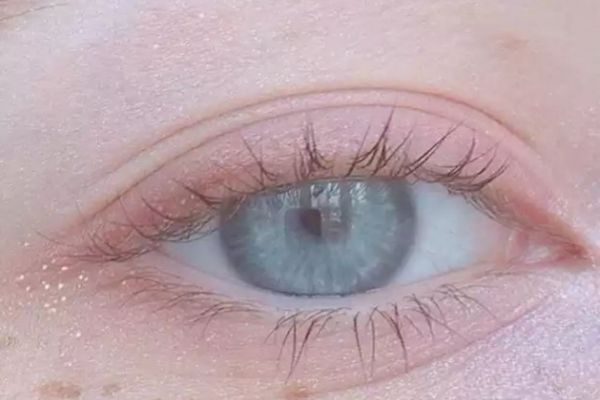 腫眼皮是怎么回事 如何避免眼皮浮腫 腫眼皮是怎么回事 如何避免眼皮浮腫