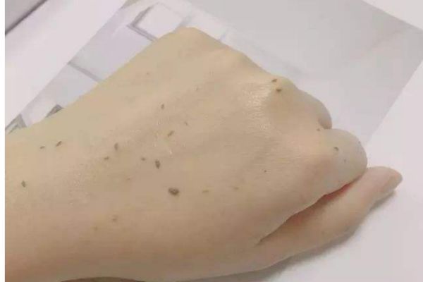 油性皮膚怎么去角質(zhì) 油性皮膚去角質(zhì)的方法 油性皮膚怎么去角質(zhì) 油性皮膚去角質(zhì)的方法