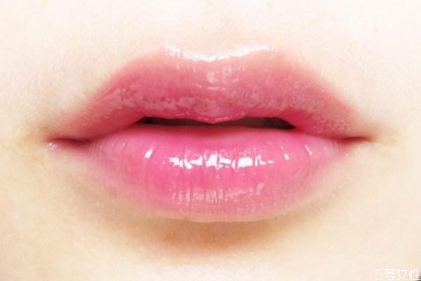 打完嘟嘟唇多久能變的自然 打完嘟嘟唇多久定型 打完嘟嘟唇多久能變的自然 打完嘟嘟唇多久定型