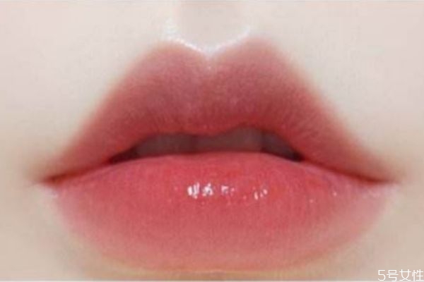 打完嘟嘟唇多久能變的自然 打完嘟嘟唇多久定型 打完嘟嘟唇多久能變的自然 打完嘟嘟唇多久定型