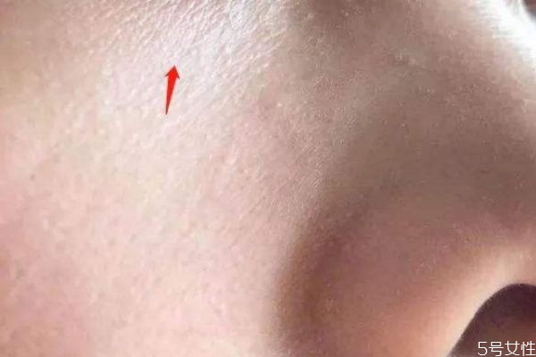 鼻子卡粉什么原因 鼻子周圍卡粉怎么回事 鼻子卡粉什么原因 鼻子周圍卡粉怎么回事