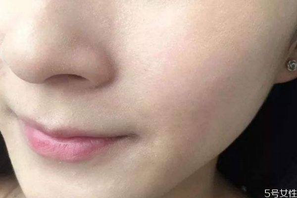 如何預(yù)防鼻子卡粉 如何解決鼻子卡粉 如何預(yù)防鼻子卡粉 如何解決鼻子卡粉