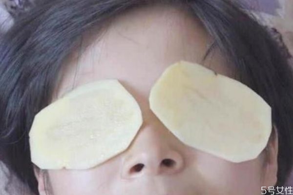 去除黑眼圈的方法有什么 怎么快速去除黑眼圈 去除黑眼圈的方法有什么 怎么快速去除黑眼圈