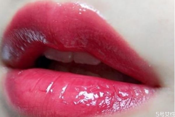 嘴唇上長泡爛了怎么辦 嘴唇上長泡可以涂紅霉素軟膏嗎 嘴唇上長泡爛了怎么辦 嘴唇上長泡可以涂紅霉素軟膏嗎