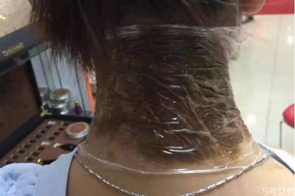 富貴包有什么危害 富貴包對身體的傷害 富貴包有什么危害 富貴包對身體的傷害