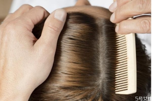 什么洗發(fā)水適合油性頭發(fā) 適合油性頭發(fā)的洗發(fā)水推薦 什么洗發(fā)水適合油性頭發(fā) 適合油性頭發(fā)的洗發(fā)水推薦