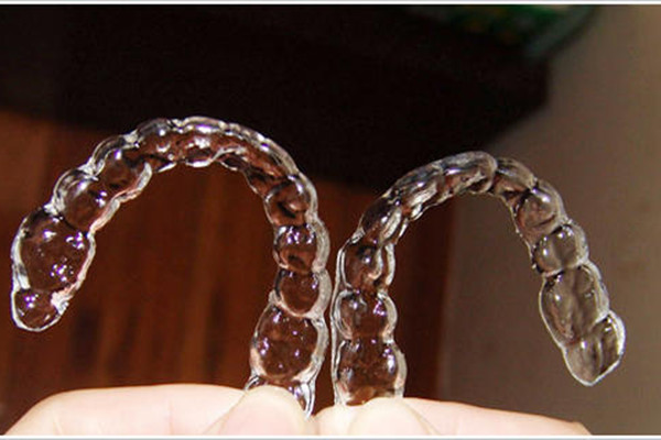 補(bǔ)牙后牙套要戴多久 補(bǔ)牙后戴牙套的時(shí)間受什么影響 補(bǔ)牙后牙套要戴多久 補(bǔ)牙后戴牙套的時(shí)間受什么影響