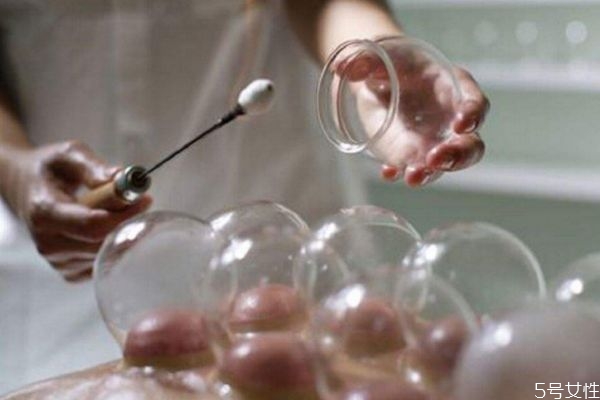 拔罐出水泡怎么回事 為什么拔罐會出水泡 拔罐出水泡怎么回事 為什么拔罐會出水泡