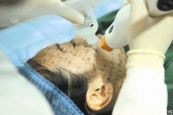 熱瑪吉五代疼不疼 第五代熱瑪吉效果 熱瑪吉五代疼不疼 第五代熱瑪吉效果