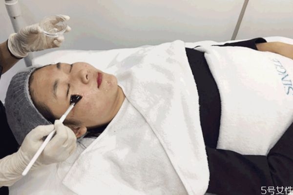 刷酸后皮膚脫皮是正常的嗎 刷酸的正確護(hù)膚步驟 刷酸后皮膚脫皮是正常的嗎 刷酸的正確護(hù)膚步驟