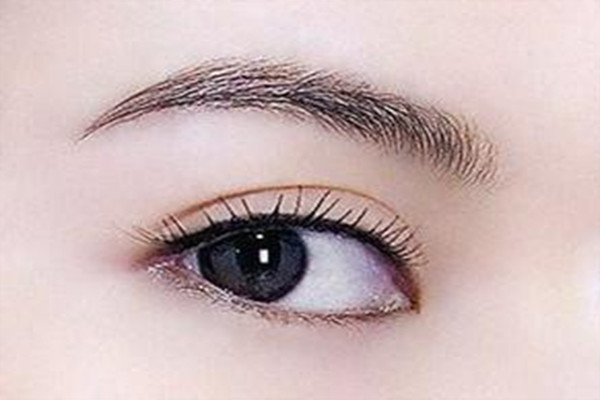 什么是雙眼皮吸脂 雙眼皮吸脂的好處 什么是雙眼皮吸脂 雙眼皮吸脂的好處