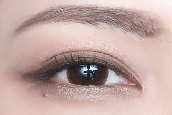 壓雙眼皮是什么 壓雙眼皮的原理 壓雙眼皮是什么 壓雙眼皮的原理