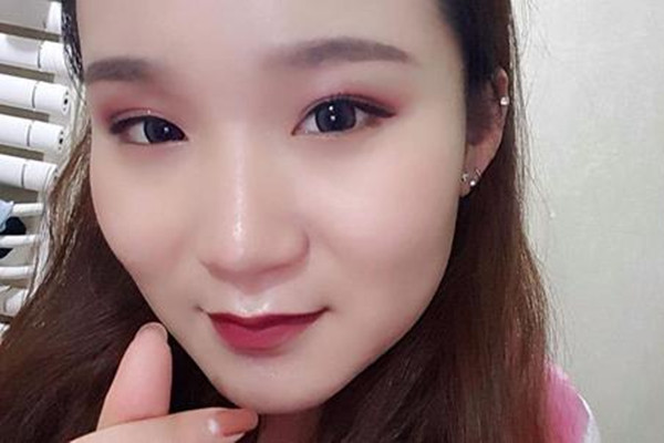 壓雙眼皮價(jià)格受什么影響 壓雙眼皮術(shù)后要注意什么 壓雙眼皮價(jià)格受什么影響 壓雙眼皮術(shù)后要注意什么