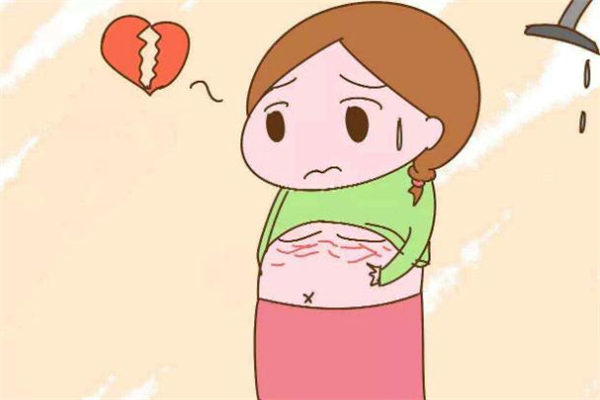 微針可以去妊娠紋嗎 微針去妊娠紋效果怎么樣 微針可以去妊娠紋嗎 微針去妊娠紋效果怎么樣