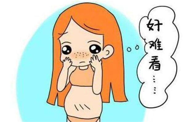 微針可以去妊娠紋嗎 微針去妊娠紋效果怎么樣 微針可以去妊娠紋嗎 微針去妊娠紋效果怎么樣