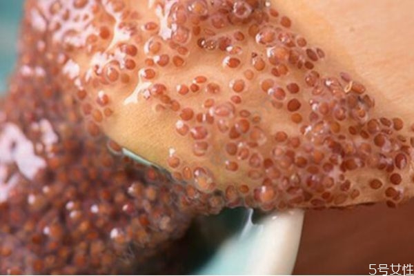 顆粒海藻面膜會(huì)不會(huì)過期 過期的海藻面膜有什么妙用 顆粒海藻面膜會(huì)不會(huì)過期 過期的海藻面膜有什么妙用