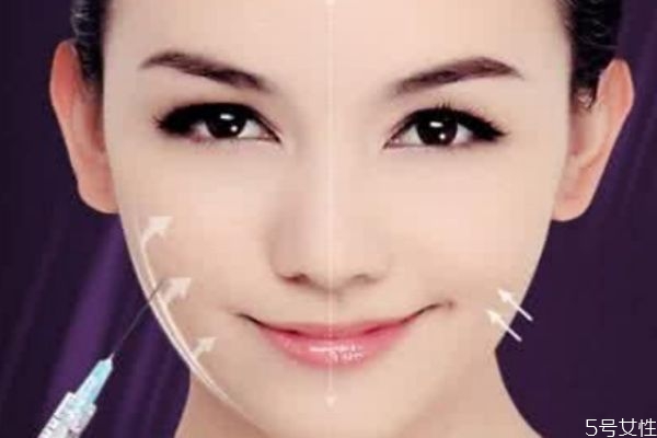 嬰兒肥可以打瘦臉針不 瘦臉針可以瘦骨頭嗎 嬰兒肥可以打瘦臉針不 瘦臉針可以瘦骨頭嗎