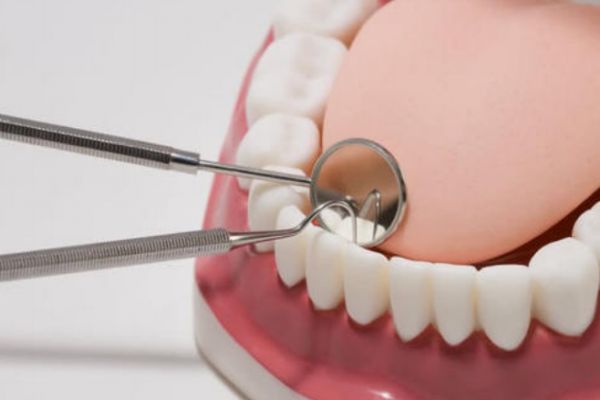 牙齒發(fā)黃應(yīng)該怎么辦 解決牙齒發(fā)黃的方法 牙齒發(fā)黃應(yīng)該怎么辦 解決牙齒發(fā)黃的方法