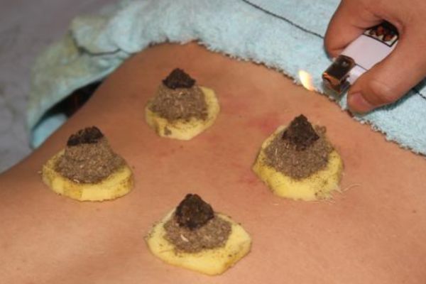 艾灸減肥的原理是什么 為什么艾灸可以減肥 艾灸減肥的原理是什么 為什么艾灸可以減肥