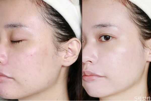 涂粉底液搓泥是怎么回事 為什么別人化妝很光滑 涂粉底液搓泥是怎么回事 為什么別人化妝很光滑