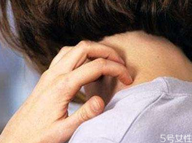 蕁麻疹檢查需要空腹嗎 蕁麻疹發(fā)出來是排毒嗎 蕁麻疹檢查需要空腹嗎 蕁麻疹發(fā)出來是排毒嗎