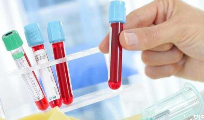 甘油三酯高就是血脂高嗎 甘油三酯高引起的高血脂有哪些危害 甘油三酯高就是血脂高嗎 甘油三酯高引起的高血脂有哪些危害