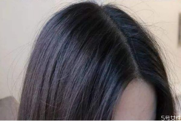 劉海三角區(qū)禿了怎么辦 頭頂劉海處禿了怎么補救 劉海三角區(qū)禿了怎么辦 頭頂劉海處禿了怎么補救