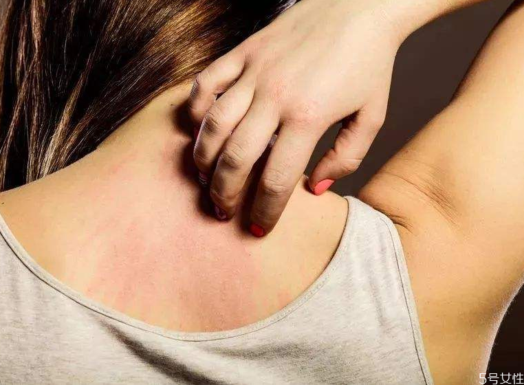 身上有螨蟲(chóng)怎么去除 身上有螨蟲(chóng)用什么洗澡 身上有螨蟲(chóng)怎么去除 身上有螨蟲(chóng)用什么洗澡