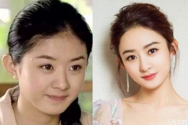 額頭發(fā)際線高怎么辦 這么做告別大額頭 額頭發(fā)際線高怎么辦 這么做告別大額頭